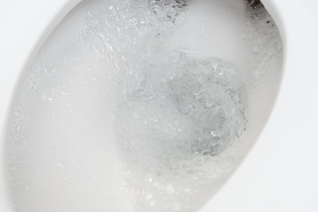 トイレの水が止まらない！まず閉める止水栓と、症状別の原因・直し方・業者を呼ぶ目安